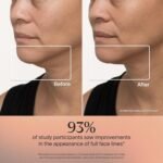 TheraFace Mask (FDA cleared LED skincare mask) - Image 11